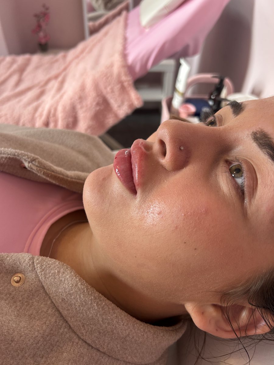 Aesthetics treatment