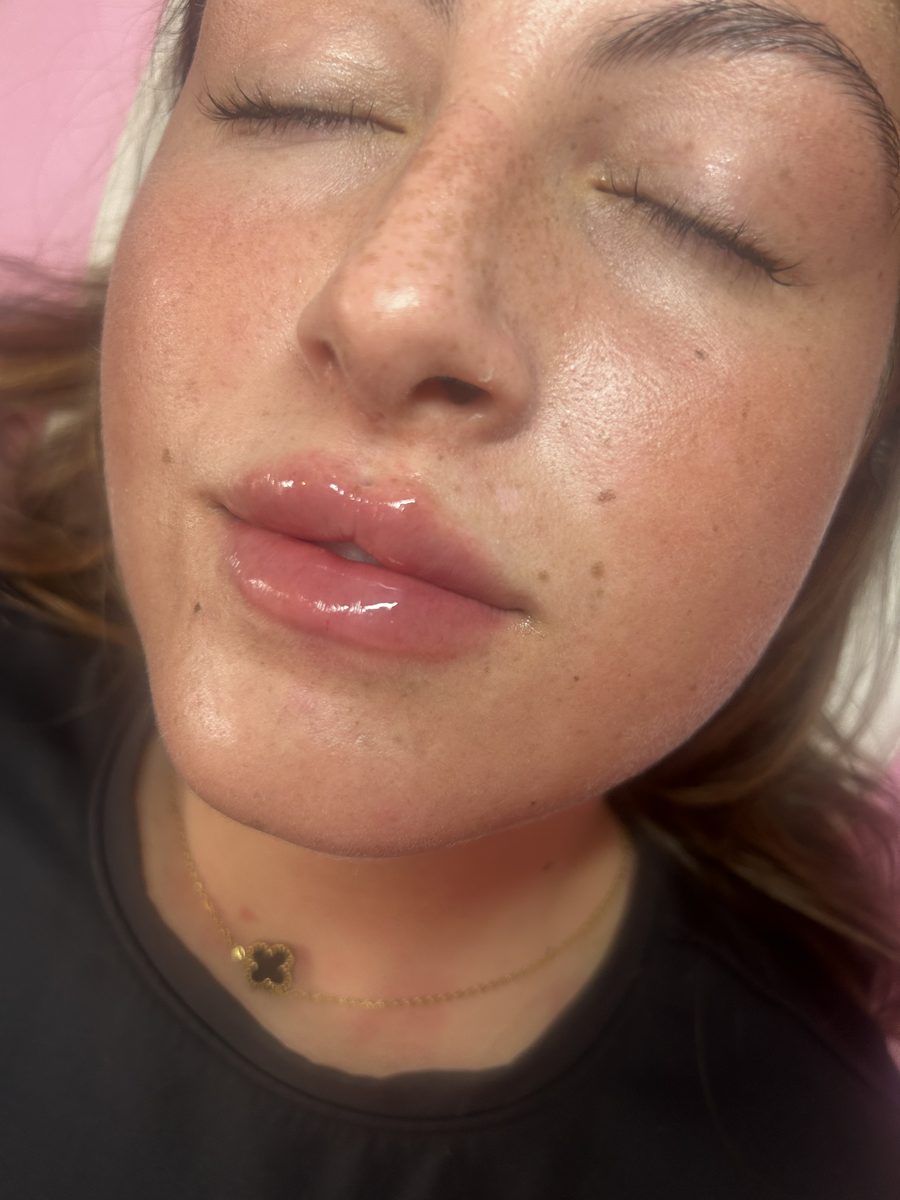 Aesthetics treatment